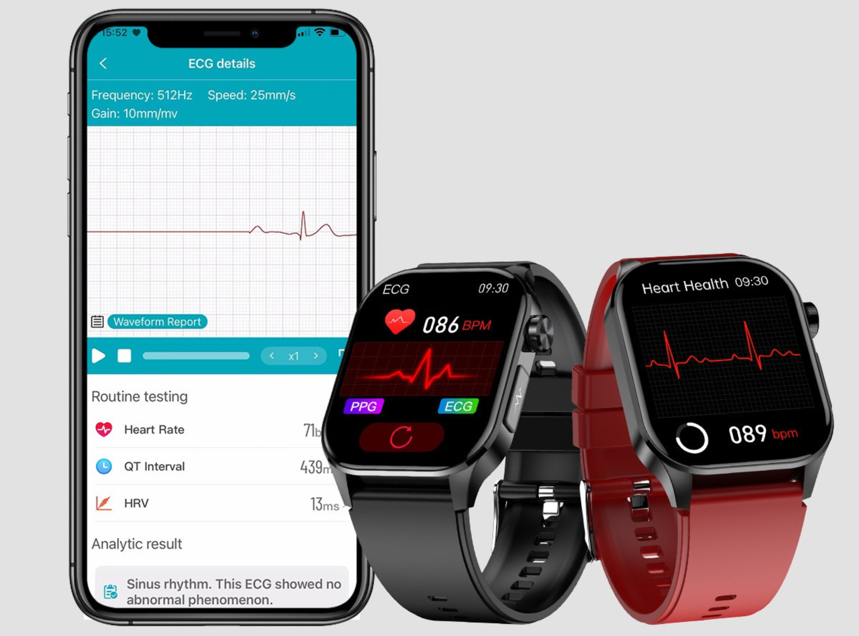 Interpretation of ECG electrocardiogram Generate electrocardiogram and analysis report on the APP all health data is clear at a glance, helping you fully grasp the health status of thei heart